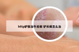http驢脹治牛皮癬 驢長癬怎么治