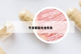 牛皮癬能吃金槍魚