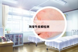 淘寶牛皮癬檢測