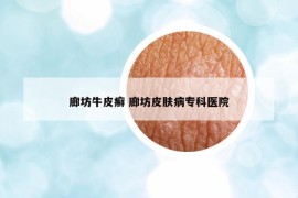 廊坊牛皮癬 廊坊皮膚病?？漆t(yī)院