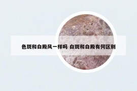 色斑和白殿風(fēng)一樣嗎 白斑和白殿有何區(qū)別