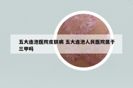 五大連池醫(yī)院皮膚病 五大連池人民醫(yī)院屬于三甲嗎