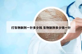 打生物制劑一針多少錢 生物制劑多少錢一針