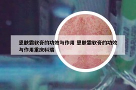 恩膚霜軟膏的功效與作用 恩膚霜軟膏的功效與作用重慶科瑞