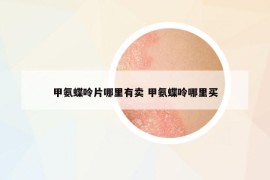 甲氨蝶呤片哪里有賣 甲氨蝶呤哪里買