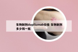 生物制劑dupilumab價(jià)格 生物制劑多少錢(qián)一瓶