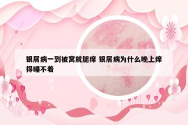銀屑病一到被窩就腿癢 銀屑病為什么晚上癢得睡不著