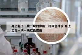 身上起了一塊一塊的像癬一樣紅色掉皮 身上出現(xiàn)一塊一塊紅色皮癬
