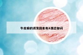 牛皮癬的誘發(fā)因素有A情志郁悶