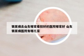 銀屑病去山東哪家看較好的醫(yī)院哪家好 山東銀屑病醫(yī)院有哪幾家