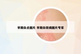 早期白點(diǎn)圖片 早期白斑病圖片專(zhuān)家