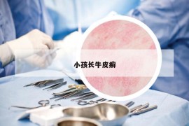 小孩長牛皮癬