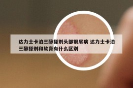 達(dá)力士卡泊三醇搽劑頭部銀屑病 達(dá)力士卡泊三醇搽劑和軟膏有什么區(qū)別