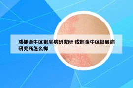 成都金牛區(qū)銀屑病研究所 成都金牛區(qū)銀屑病研究所怎么樣