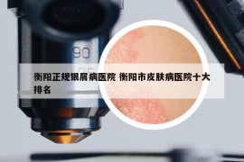 衡陽(yáng)正規(guī)銀屑病醫(yī)院 衡陽(yáng)市皮膚病醫(yī)院十大排名