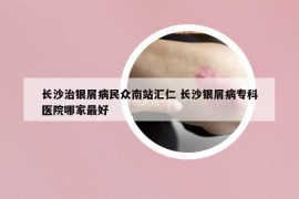 長沙治銀屑病民眾南站匯仁 長沙銀屑病?？漆t(yī)院哪家最好