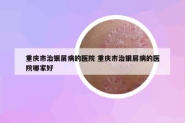 重慶市治銀屑病的醫(yī)院 重慶市治銀屑病的醫(yī)院哪家好