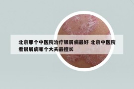 北京那個中醫(yī)院治療銀屑病最好 北京中醫(yī)院看銀屑病哪個大夫最擅長