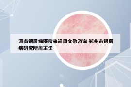 河南銀屑病醫(yī)院來問周文敬咨詢 鄭州市銀屑病研究所周主任
