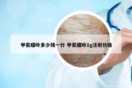 甲氨蝶呤多少錢一針 甲氨蝶呤1g注射價(jià)格