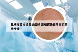 昆明哪里治銀屑病最好 昆明醫(yī)治銀屑哪家醫(yī)院專(zhuān)業(yè)