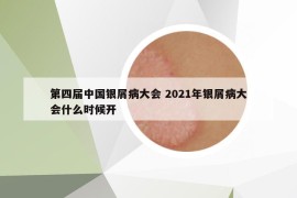 第四屆中國銀屑病大會(huì) 2021年銀屑病大會(huì)什么時(shí)候開