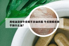 用啥油涂抹牛皮癬不會(huì)油衣服 牛皮膚癬皮膚干抹什么油?