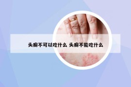 頭癬不可以吃什么 頭癬不能吃什么