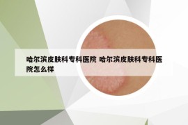 哈爾濱皮膚科專科醫(yī)院 哈爾濱皮膚科?？漆t(yī)院怎么樣