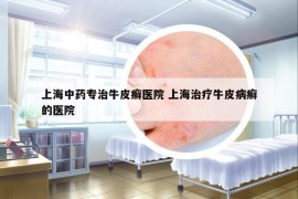 上海中藥專(zhuān)治牛皮癬醫(yī)院 上海治療牛皮病癬的醫(yī)院