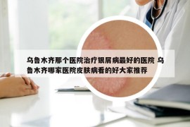 烏魯木齊那個醫(yī)院治療銀屑病最好的醫(yī)院 烏魯木齊哪家醫(yī)院皮膚病看的好大家推薦