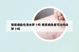 銀屑病能吃清水蘿卜嗎 銀屑病患者可以吃白蘿卜嗎