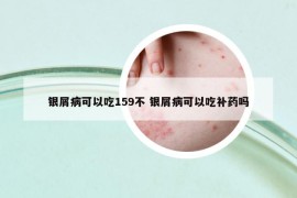 銀屑病可以吃159不 銀屑病可以吃補(bǔ)藥嗎