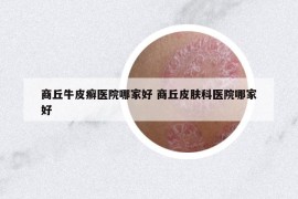 商丘牛皮癬醫(yī)院哪家好 商丘皮膚科醫(yī)院哪家好