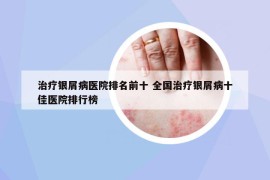 治療銀屑病醫(yī)院排名前十 全國治療銀屑病十佳醫(yī)院排行榜