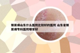 銀屑病山東什么醫(yī)院比較好的醫(yī)院 山東省銀屑病?？漆t(yī)院哪家好