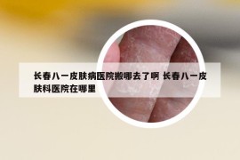 長(zhǎng)春八一皮膚病醫(yī)院搬哪去了啊 長(zhǎng)春八一皮膚科醫(yī)院在哪里