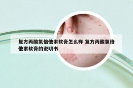 復(fù)方丙酸氯倍他索軟膏怎么樣 復(fù)方丙酸氯倍他索軟膏的說(shuō)明書(shū)