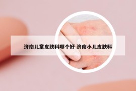 濟南兒童皮膚科哪個好 濟南小兒皮膚科