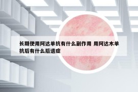長期使用阿達單抗有什么副作用 用阿達木單抗后有什么后遺癥
