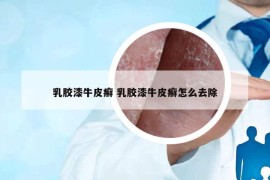 乳膠漆牛皮癬 乳膠漆牛皮癬怎么去除