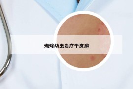 蟾蜍幼蟲治療牛皮癬