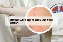 銀屑病14年用青霉素 銀屑病可以用青霉素輸液?jiǎn)?