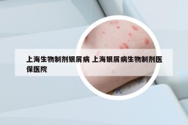 上海生物制劑銀屑病 上海銀屑病生物制劑醫(yī)保醫(yī)院