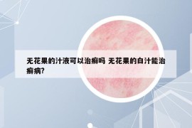 無花果的汁液可以治癬嗎 無花果的白汁能治癬病?