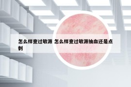 怎么樣查過(guò)敏源 怎么樣查過(guò)敏源抽血還是點(diǎn)刺