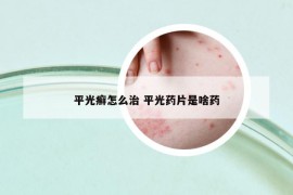 平光癬怎么治 平光藥片是啥藥