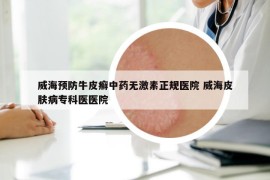 威海預(yù)防牛皮癬中藥無(wú)激素正規(guī)醫(yī)院 威海皮膚病?？漆t(yī)醫(yī)院