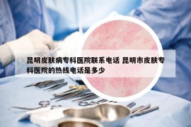 昆明皮膚病?？漆t(yī)院聯(lián)系電話 昆明市皮膚?？漆t(yī)院的熱線電話是多少