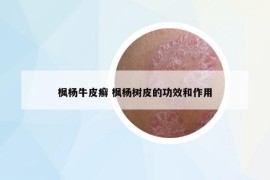 楓楊牛皮癬 楓楊樹皮的功效和作用